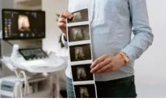 Mujer con dos úteros se embaraza en los dos al mismo tiempo