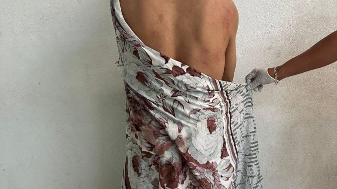 Sujeto que tenía un machete en su poder y hacía disturbio al interior de su domicilio fue detenido por la Policía Municipal de Aguascalientes
