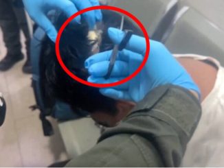 Narcopeluca: intentó contrabandear droga bajo un tupé en Colombia