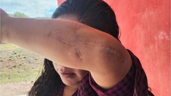'Temo por mi vida, un juez liberó a quien quiso matarme': mixteca víctima de intento de feminicidio