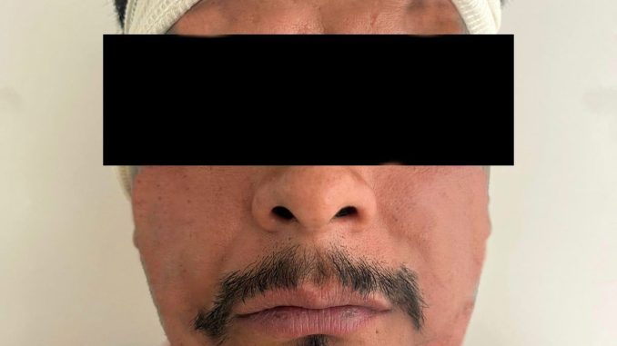 Policía Municipal detiene a sujeto por posesión de sustancias ilícitas en Santa Anita