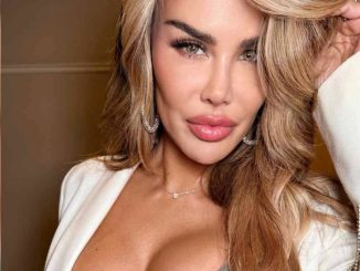 Ninel Conde se somete a cirugía para cambiar el color de sus ojos