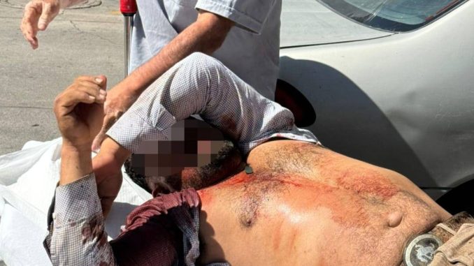 Uniformados de la Policía Estatal abren paso a un vehículo en dónde trasladaban a una persona lesionada por caída de 3 metros de altura