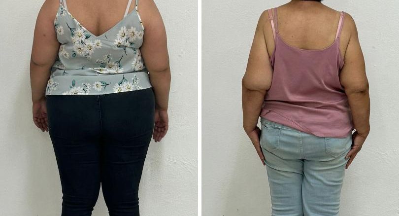 Detiene Policía Municipal a dos Mujeres señaladas por violencia familiar en el Barrio de San Marcos