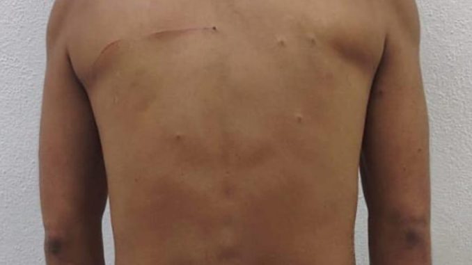 Policías Estatales detienen a sujeto señalado como presunto responsable de lesiones y tocamientos en agravio de persona de sexo femenino