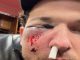 Accidente en Grandes Ligas: pelotazo manda al hospital a Alex Bregman