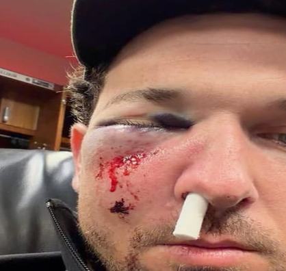 Accidente en Grandes Ligas: pelotazo manda al hospital a Alex Bregman