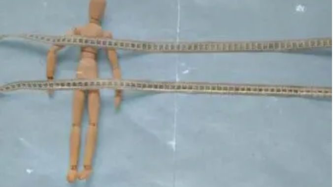 Tasas de anorexia y bulimia se disparan más de un 70% desde 1990 y seguirán en aumento