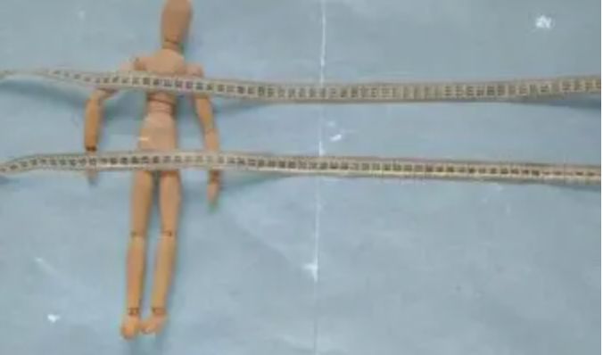 Tasas de anorexia y bulimia se disparan más de un 70% desde 1990 y seguirán en aumento